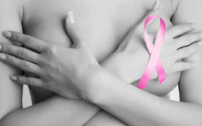 Trabajan en programa territorial en V Región para ayudar a mujerescon cáncer de mama