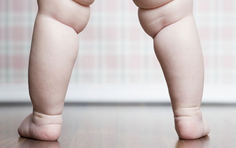 OMS lanza iniciativa para acabar con obesidad infantil ante su “preocupante” aumento