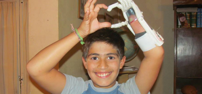Jóvenes argentinos crean mano artificial a través de impresora 3D