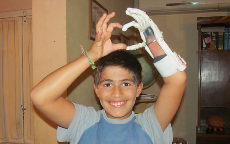 Jóvenes argentinos crean mano artificial a través de impresora 3D