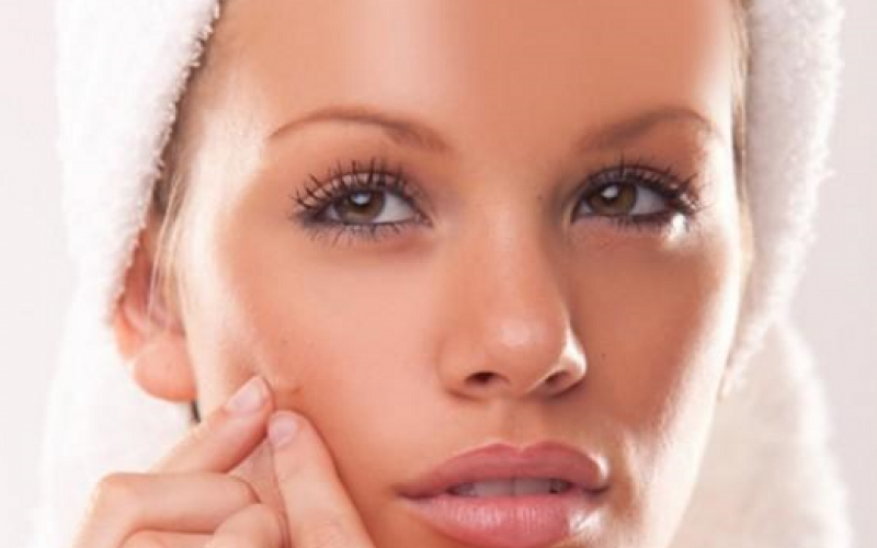 Cuidados para pieles con acné