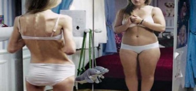 Anorexia: los peligros de dejar de comer