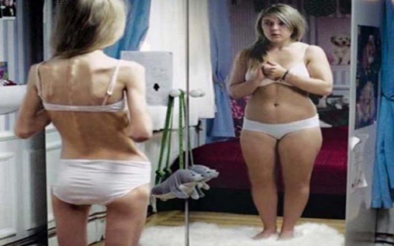Anorexia: los peligros de dejar de comer