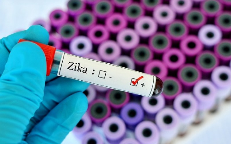 Ahora que llegó a Chile, sepa cómo combatir el Zika
