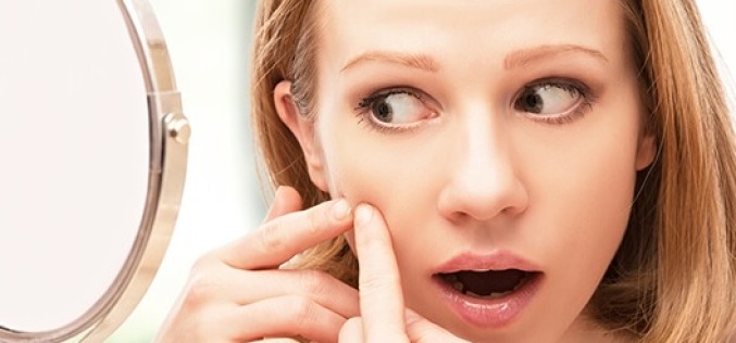 Secuelas de acné: Cuando ciertas etapas de la vida dejan sus marcas en la piel