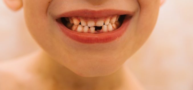 Traumatismo dental: ¿Cuáles son las consecuencias de un golpe en los dientes?