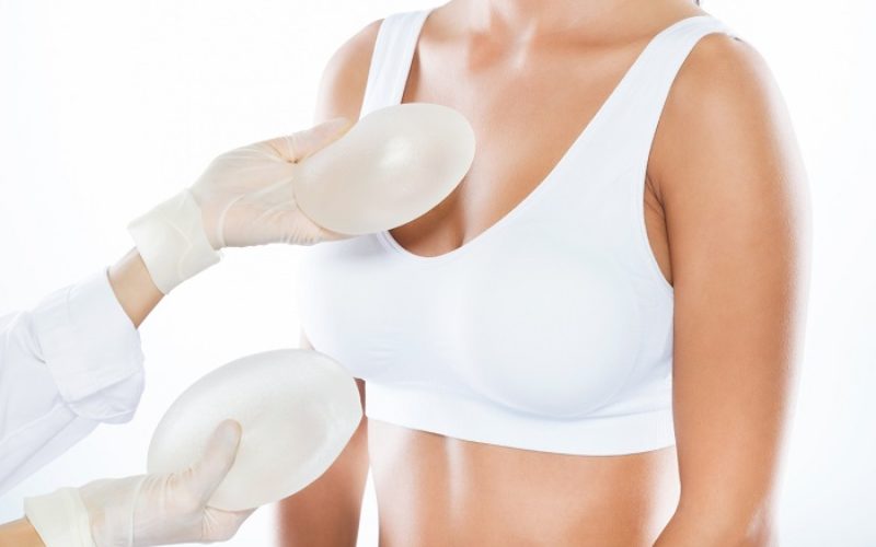 Mitos y verdades de los implantes mamarios