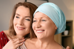 Cómo enfrentar el complejo proceso de la pérdida de cabello en el cáncer de mama