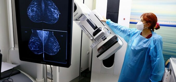 Mamografía: su importancia y qué necesitas para agendar la tuya