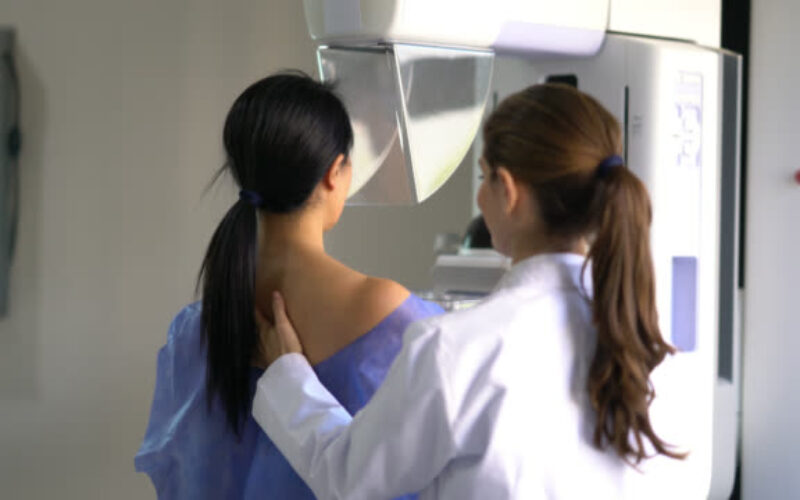 Sportlife entrega descuentos en mamografías en Clínica Meds La Dehesa
